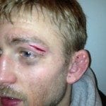 alexander-gustafsson-cut