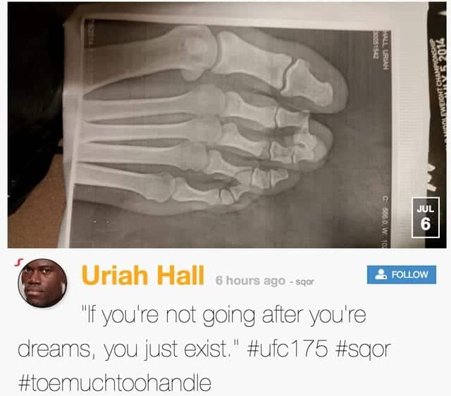 uriah-hall-ufc-175-xray