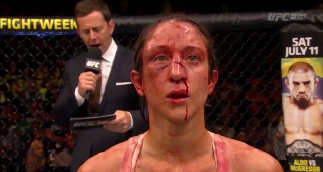 Jessica Penne efter matchens avbryt mot Joanna Jedrzejczyk på UFC Fight Night 69