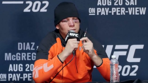 in-loss-and-vape-smoke-nate-diaz-still-endures333