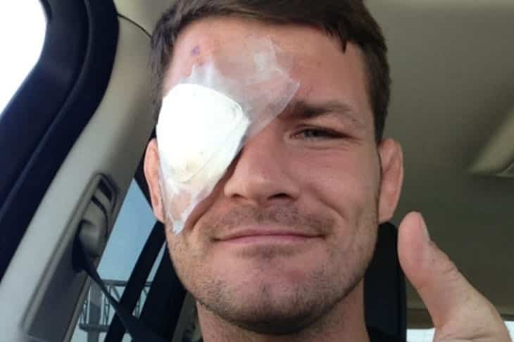 michael-bisping-eye-mmanytt