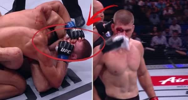 Li Jingliang Foul Jake Matthews UFC 221