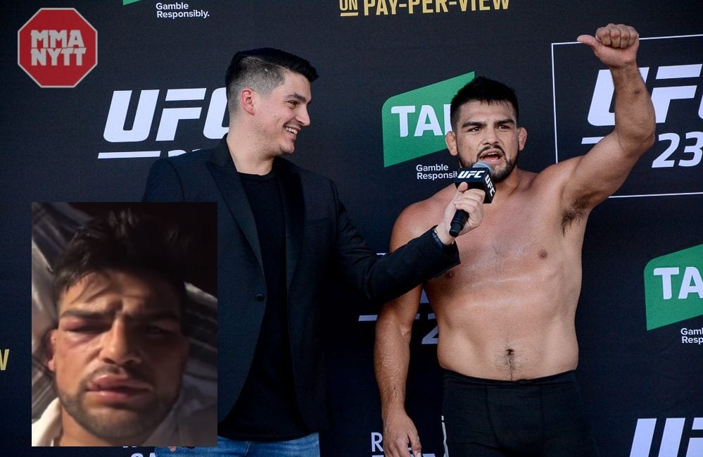 Kelvin-Gastelum-open-workout-1-1000×652