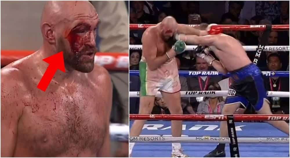 otto wallin tyson fury cut 35