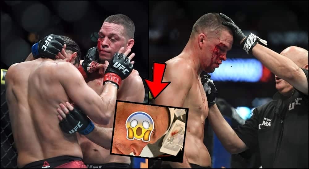 Nate Diaz Jorge Masvidal UFC 244 Foto USA TODAY Sports _ Screenshot