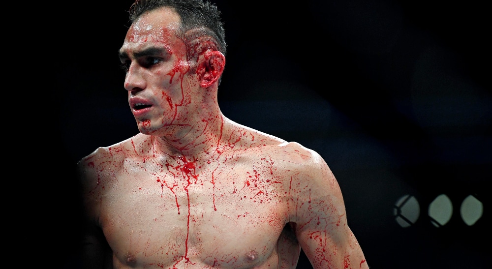 Tony Ferguson Foto USA TODAY Sports (1)