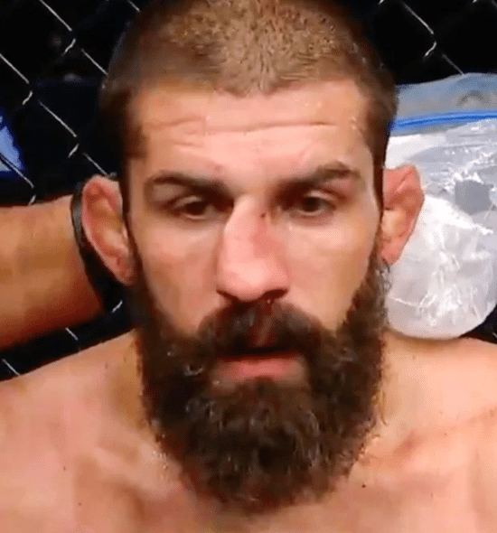 Court McGee Carlos Condit UFC MMA nose