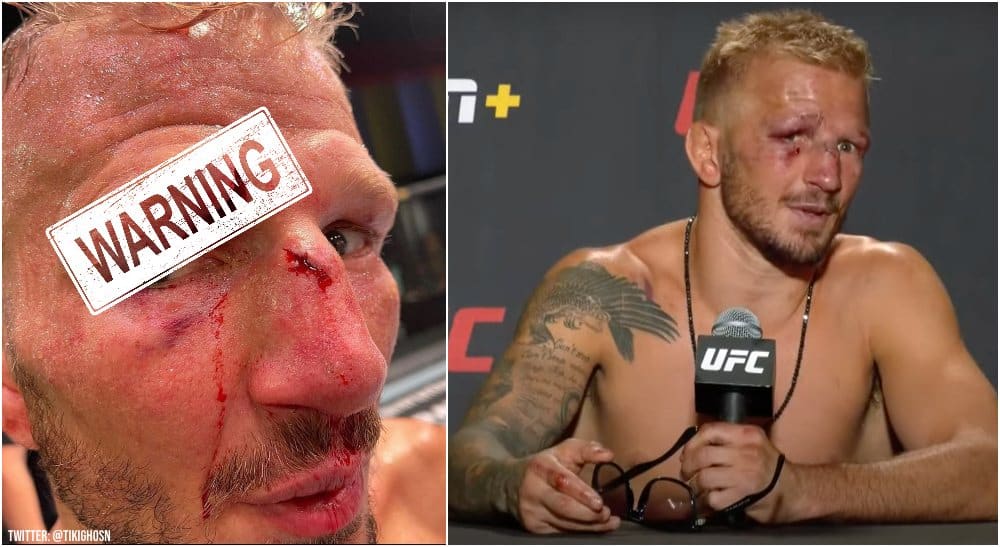 TJ Dillashaw UFC MMAnytt (Twitter @ @tikighosn)