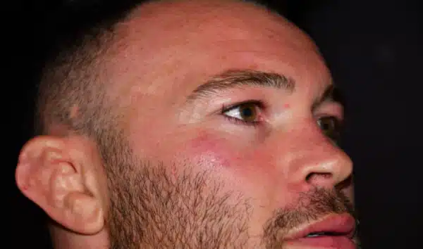 colby-covington-after-masvidal-attack-2