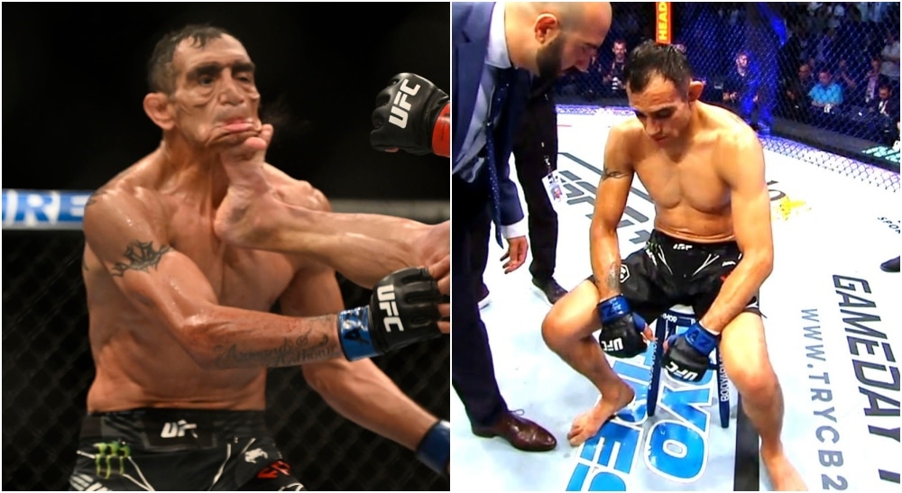 Tony Ferguson