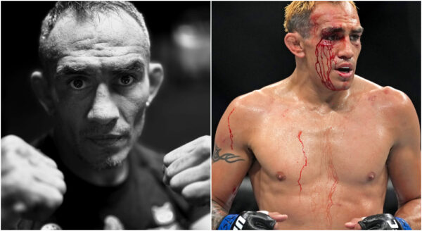 Tony Ferguson